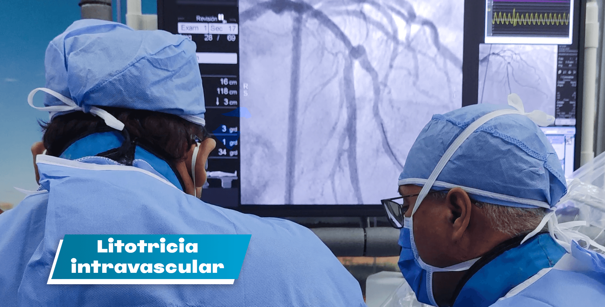 Litotricia intravascular - Laboratorio Hemodinamia HCC
