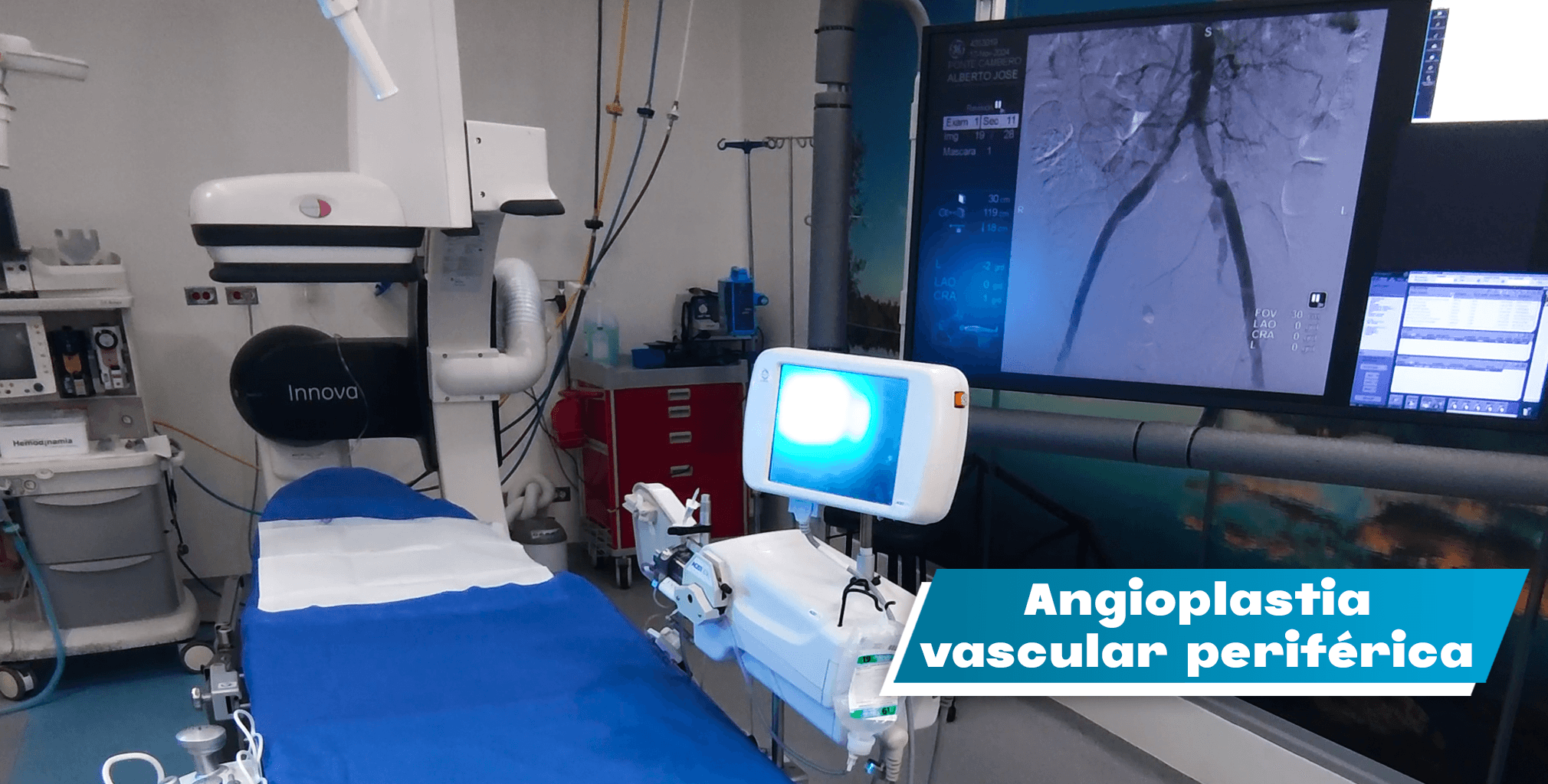 Angioplastia Vascular Periférica